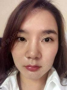 吃瓜抠鼻子怎么办视频教程,吃瓜抠鼻子两不误的实用技巧